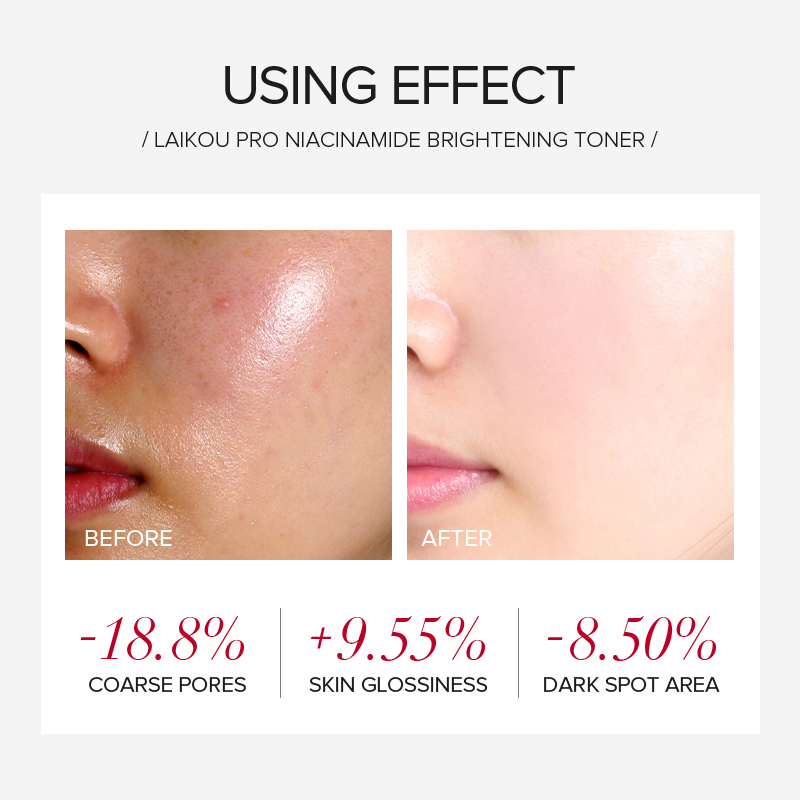 LAIKOU PRO Niacinamide 4Pcs Br - огляд і ціна Skincare Routine
